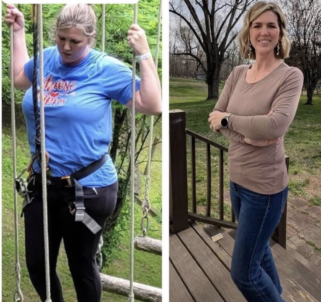 Transformation — before and after