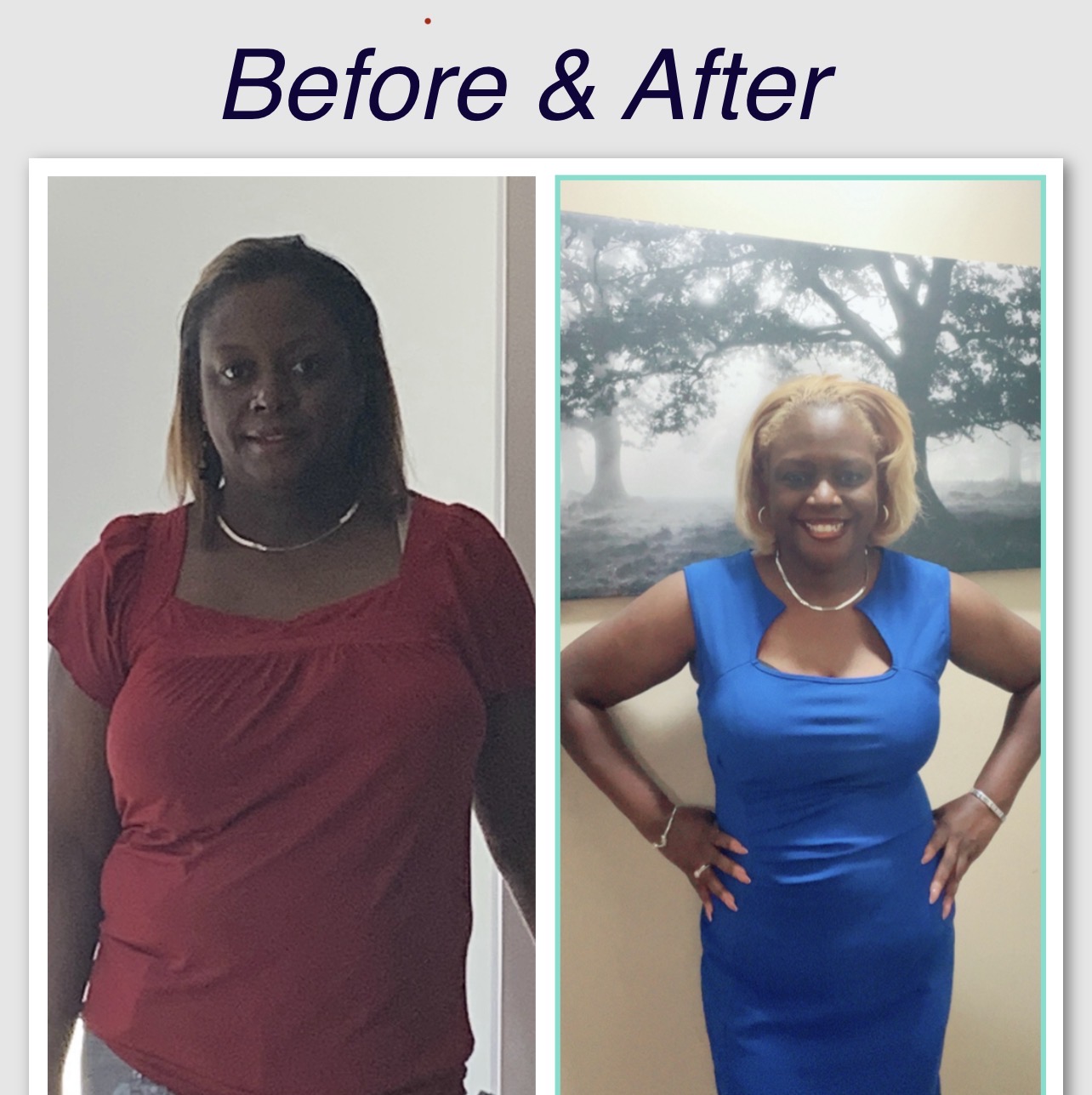 Yolanda before and after 6 months on the Feel Great System