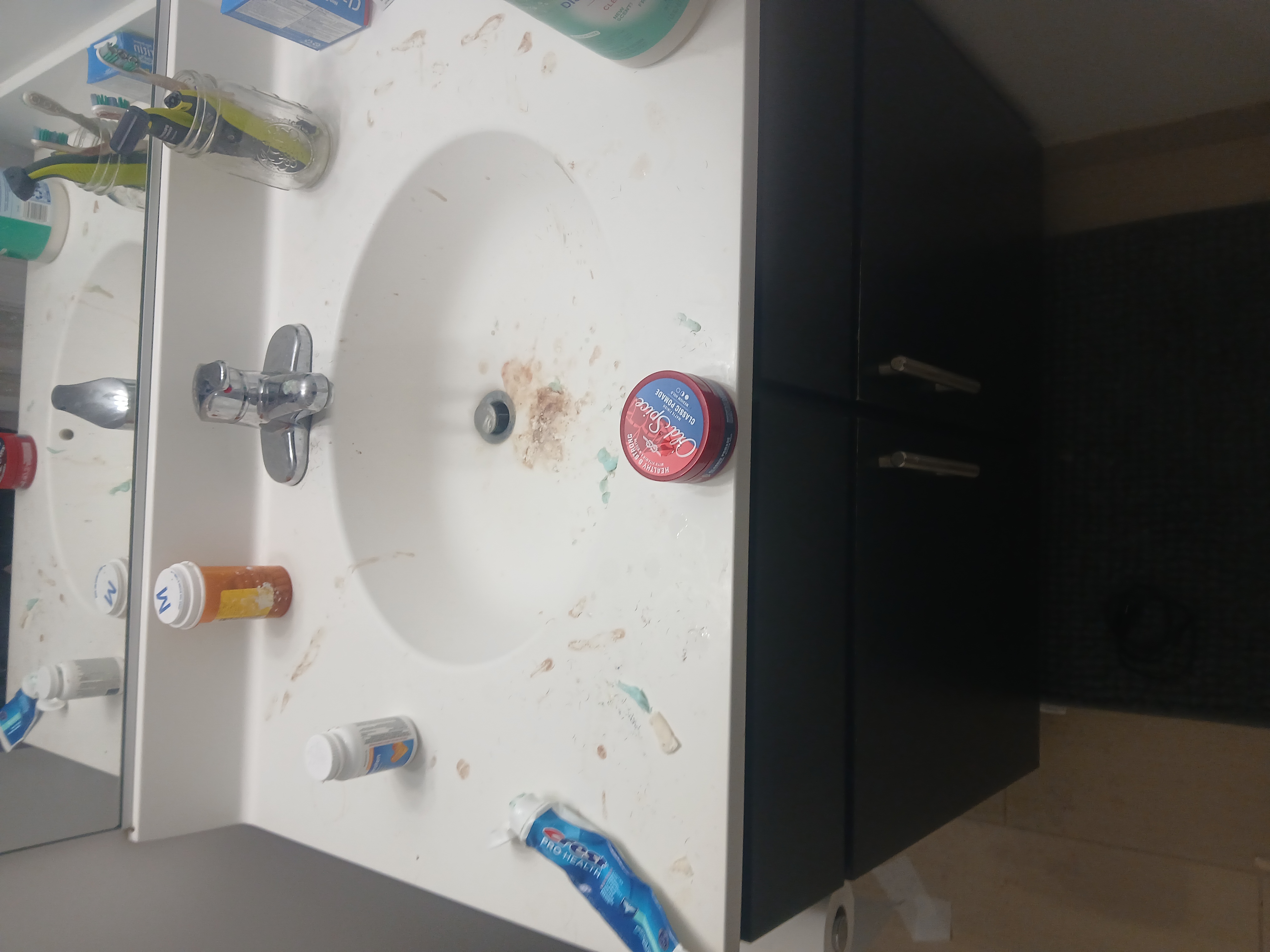 Bathroom sink before — heavy grime and mineral deposits