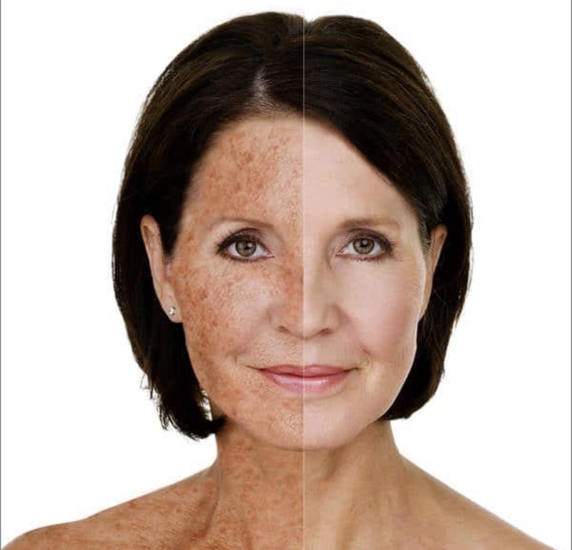 Mineral zinc oxide titanium dioxide vs chemical avobenzone octocrylene sunscreen