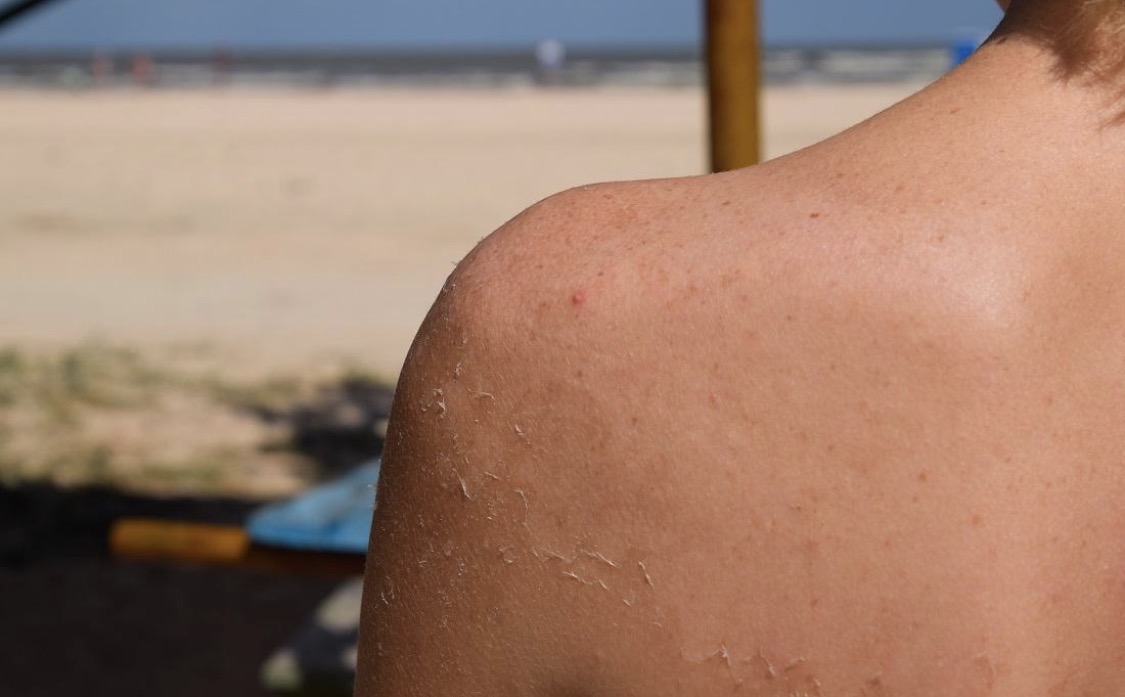 Mineral sunscreen reflects UV chemical sunscreen absorbs UV comparison