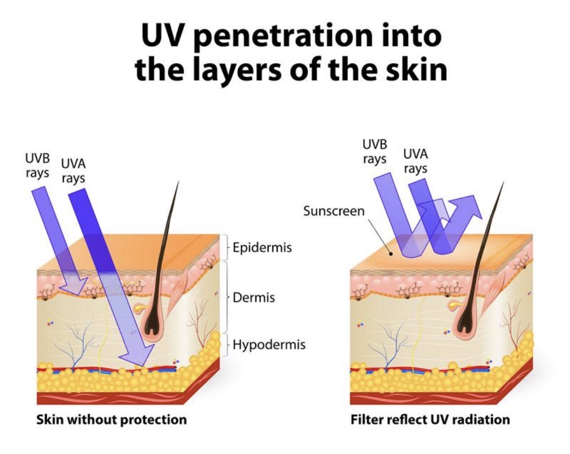 Skin aging from sun damage