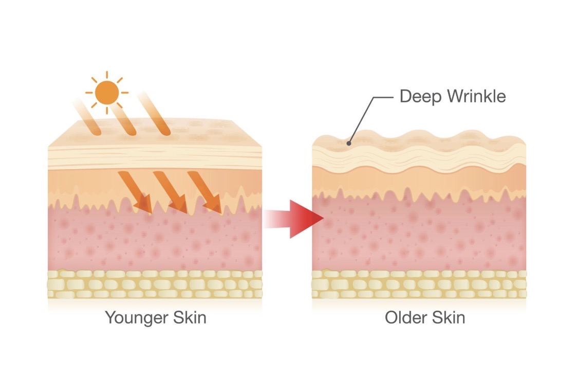 Chemical vs mineral sunscreen detailed comparison