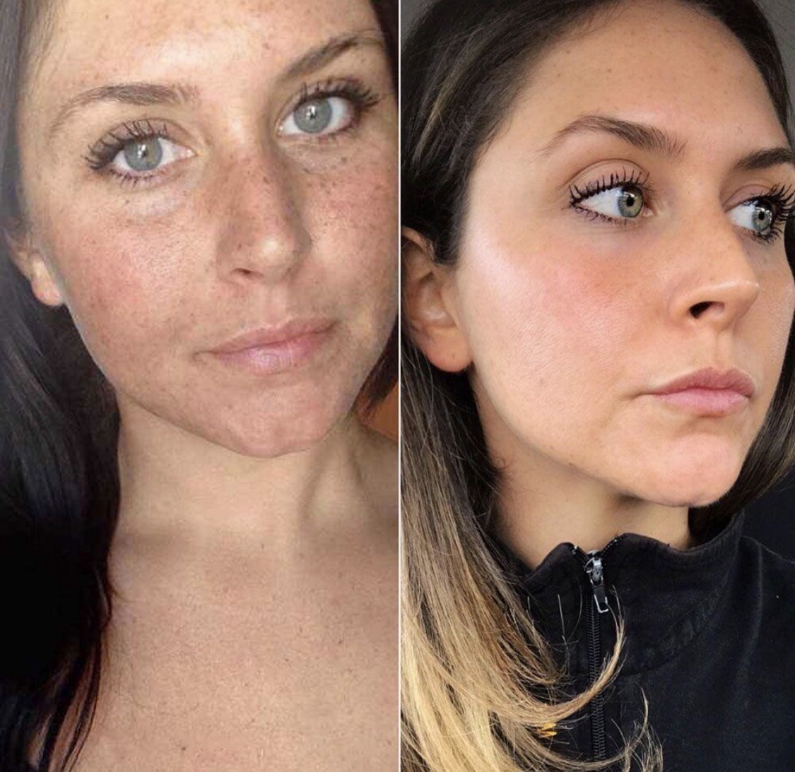 Sun protection chemical vs mineral sunscreen infographic