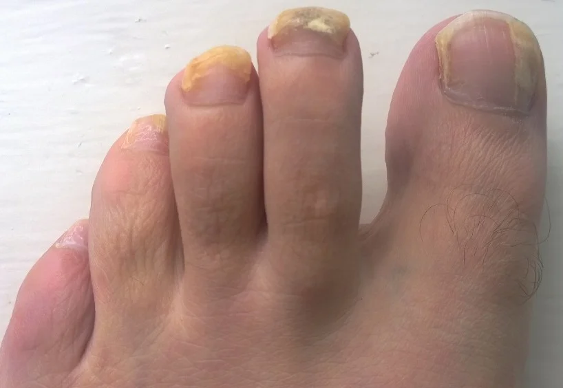 YellowNail