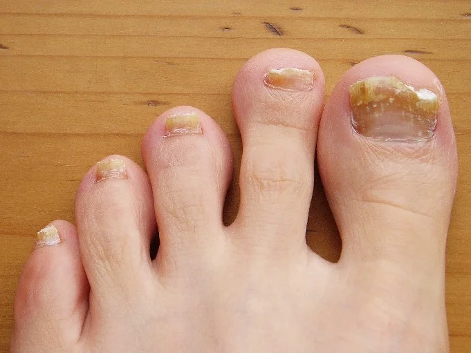 NailDebris